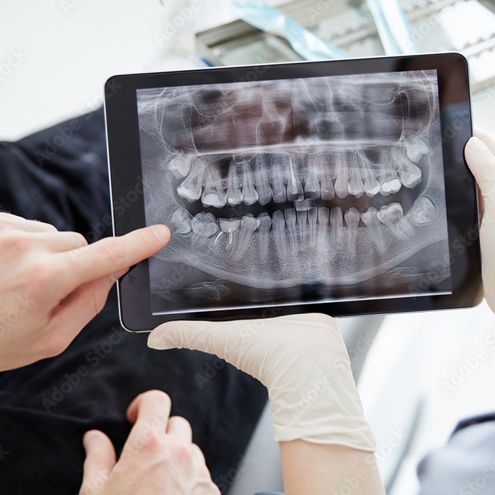 Digitales Röntgen Digitales Röntgen